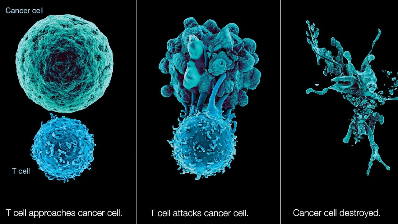 kanser tedavisinde sevindirici bir gelisme yasandi 1 lnXYtlg9