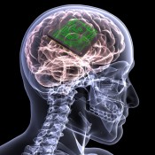 memory-chip-brain-implant