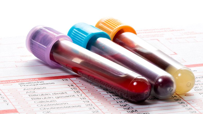 COVID-19 Kan Testi, Hastalığın Geleceğini Öngörüyor